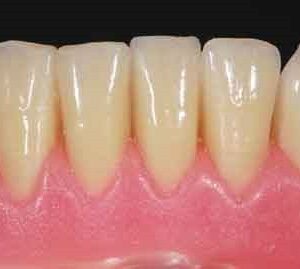 Cire Standard Morsa Dental